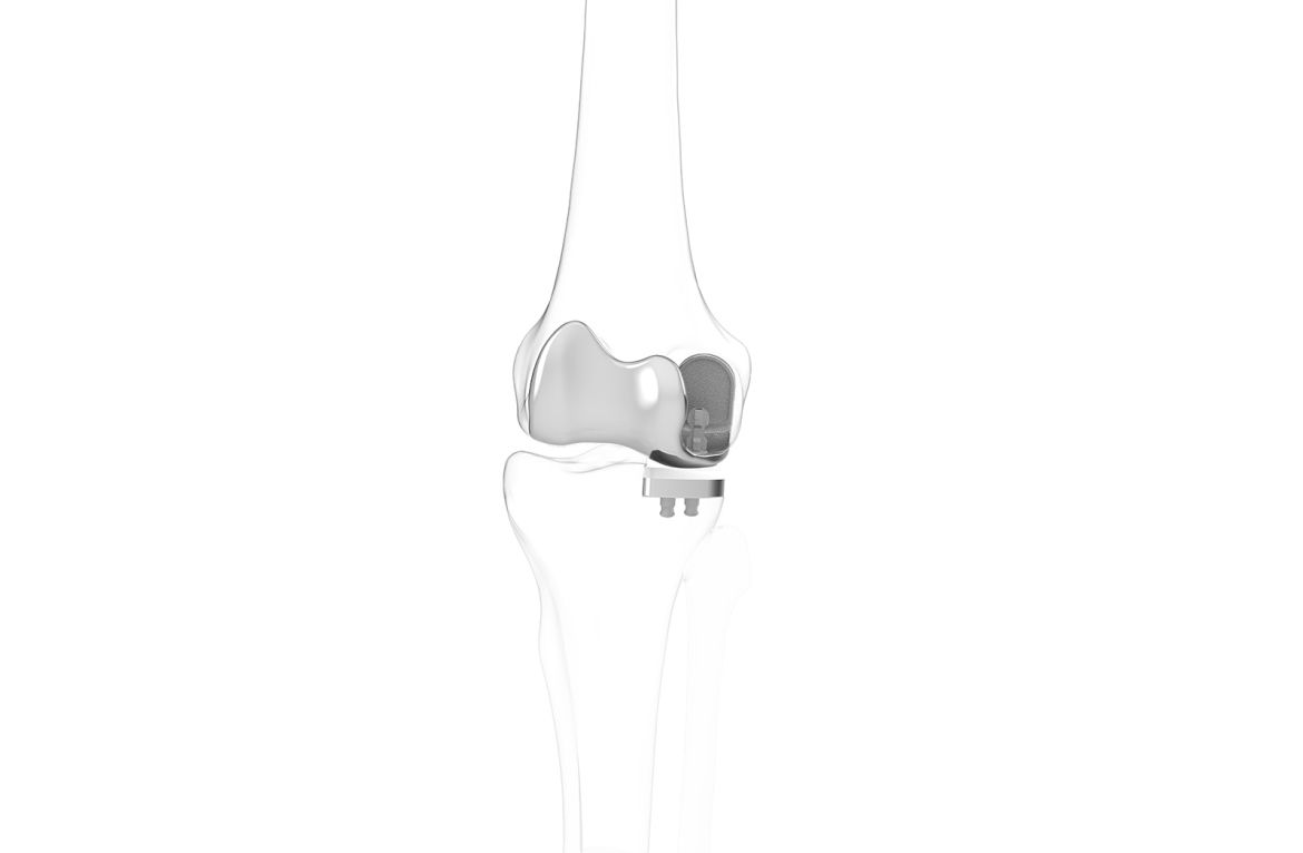 iDuo